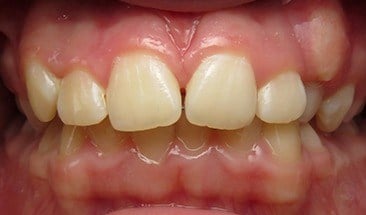 After